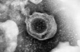 Relevantes avances sobre la capacidad del sistema inmunitario humano para hacer frente al citomegalovirus